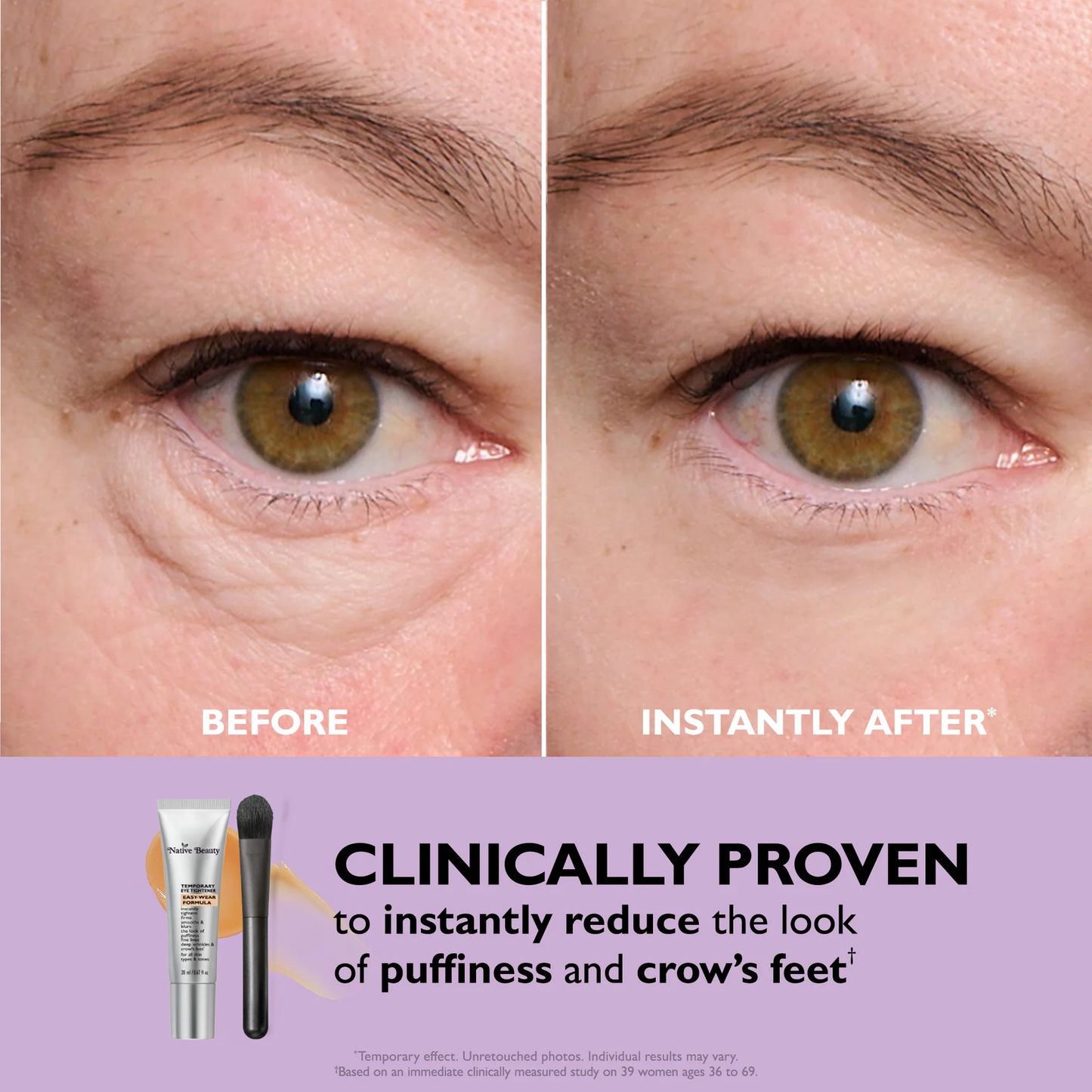Kassy™ Skin Firming Eye bag Cream