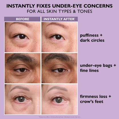 Kassy™ Skin Firming Eye bag Cream